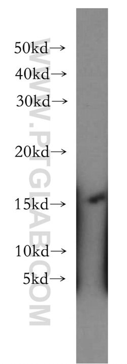 LIMD2 Rabbit anti-Human, Mouse, Rat, Polyclonal, Proteintech:Antibodies:Primary