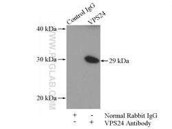 VPS24 Rabbit anti-Human, Polyclonal, Proteintech 20 &mu;L | Buy Online | Proteintech | Fisher Scientific