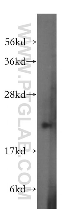 RAB31 Rabbit anti-Human, Polyclonal, Proteintech 150 &mu;L; Unconjugated:Antibodies,