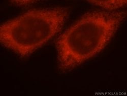 THTPA Rabbit anti-Human, Mouse, Rat, Polyclonal, Proteintech:Antibodies:Primary