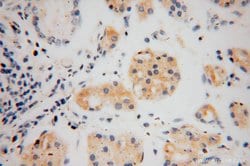 THTPA Rabbit anti-Human, Mouse, Rat, Polyclonal, Proteintech:Antibodies:Primary