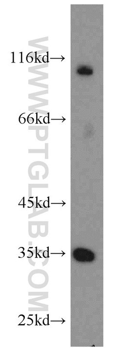 THTPA Rabbit anti-Human, Mouse, Rat, Polyclonal, Proteintech:Antibodies:Primary