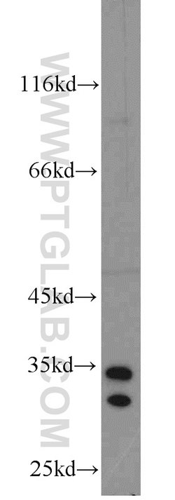 THTPA Rabbit anti-Human, Mouse, Rat, Polyclonal, Proteintech:Antibodies:Primary