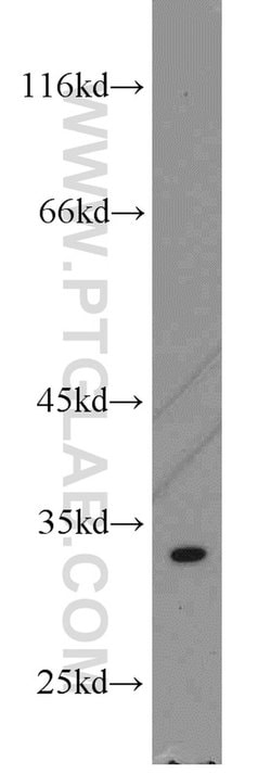 THTPA Rabbit anti-Human, Mouse, Rat, Polyclonal, Proteintech:Antibodies:Primary
