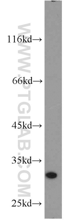 THTPA Rabbit anti-Human, Mouse, Rat, Polyclonal, Proteintech:Antibodies:Primary