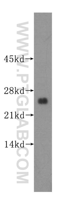 THTPA Rabbit anti-Human, Mouse, Rat, Polyclonal, Proteintech:Antibodies:Primary