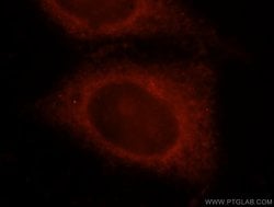 OSBPL10 Rabbit anti-Human, Mouse, Rat, Polyclonal, Proteintech 150 &mu;L;