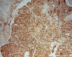OSBPL10 Rabbit anti-Human, Mouse, Rat, Polyclonal, Proteintech 150 &mu;L;