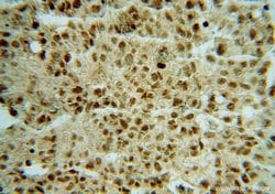 OSBPL10 Rabbit anti-Human, Mouse, Rat, Polyclonal, Proteintech 150 &mu;L;