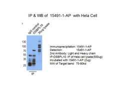 OSBPL10 Rabbit anti-Human, Mouse, Rat, Polyclonal, Proteintech 150 &mu;L;