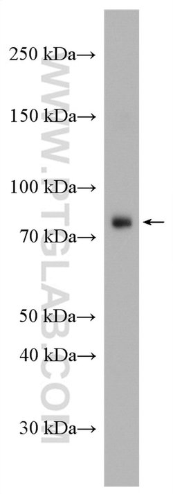 OSBPL10 Rabbit anti-Human, Mouse, Rat, Polyclonal, Proteintech 150 &mu;L;