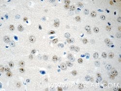 RUNX1T1 Rabbit anti-Human, Mouse, Polyclonal, Proteintech 20 &mu;L; Unconjugated:Antibodies,