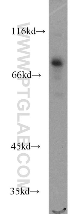 RUNX1T1 Rabbit anti-Human, Mouse, Polyclonal, Proteintech 20 &mu;L; Unconjugated:Antibodies,