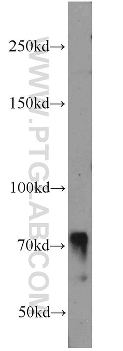 RUNX1T1 Rabbit anti-Human, Mouse, Polyclonal, Proteintech 20 &mu;L; Unconjugated:Antibodies,