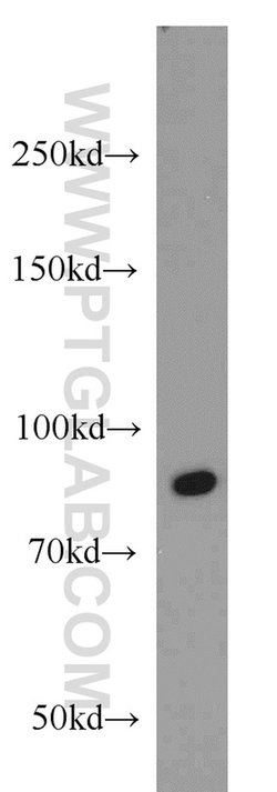 RUNX1T1 Rabbit anti-Human, Mouse, Polyclonal, Proteintech 20 &mu;L; Unconjugated:Antibodies,