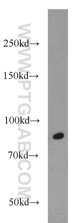 RUNX1T1 Rabbit anti-Human, Mouse, Polyclonal, Proteintech 20 &mu;L; Unconjugated:Antibodies,
