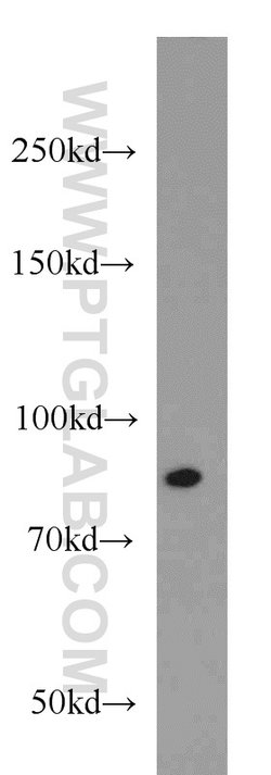 RUNX1T1 Rabbit anti-Human, Mouse, Polyclonal, Proteintech 20 &mu;L; Unconjugated:Antibodies,