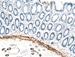 transgelin/SM22 Rabbit anti-Human, Mouse, Rat, Polyclonal, Proteintech:Antibodies:Primary