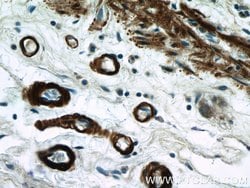 transgelin/SM22 Rabbit anti-Human, Mouse, Rat, Polyclonal, Proteintech:Antibodies:Primary