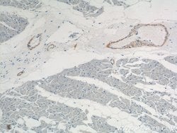 transgelin/SM22 Rabbit anti-Human, Mouse, Rat, Polyclonal, Proteintech:Antibodies:Primary