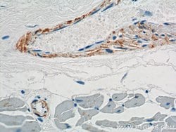 transgelin/SM22 Rabbit anti-Human, Mouse, Rat, Polyclonal, Proteintech:Antibodies:Primary