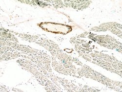 transgelin/SM22 Rabbit anti-Human, Mouse, Rat, Polyclonal, Proteintech:Antibodies:Primary