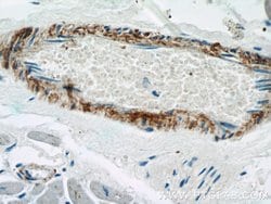 transgelin/SM22 Rabbit anti-Human, Mouse, Rat, Polyclonal, Proteintech:Antibodies:Primary