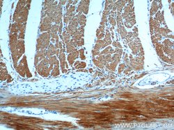 transgelin/SM22 Rabbit anti-Human, Mouse, Rat, Polyclonal, Proteintech:Antibodies:Primary