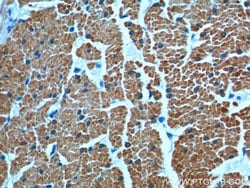 transgelin/SM22 Rabbit anti-Human, Mouse, Rat, Polyclonal, Proteintech:Antibodies:Primary