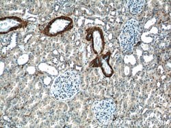 transgelin/SM22 Rabbit anti-Human, Mouse, Rat, Polyclonal, Proteintech:Antibodies:Primary