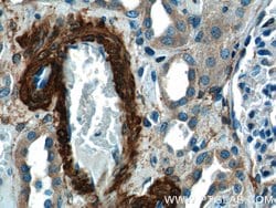 transgelin/SM22 Rabbit anti-Human, Mouse, Rat, Polyclonal, Proteintech:Antibodies:Primary