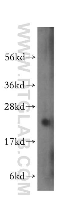 transgelin/SM22 Rabbit anti-Human, Mouse, Rat, Polyclonal, Proteintech:Antibodies:Primary