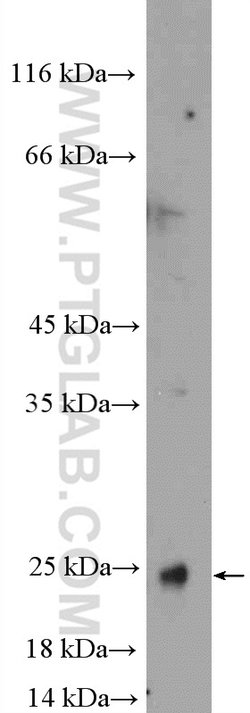 transgelin/SM22 Rabbit anti-Human, Mouse, Rat, Polyclonal, Proteintech:Antibodies:Primary