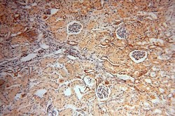 Transgelin-2 Rabbit anti-Human, Mouse, Rat, Polyclonal, Proteintech 150