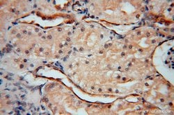 Transgelin-2 Rabbit anti-Human, Mouse, Rat, Polyclonal, Proteintech 150