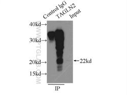 Transgelin-2 Rabbit anti-Human, Mouse, Rat, Polyclonal, Proteintech 150