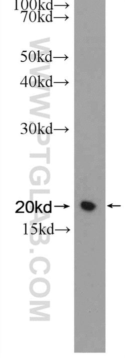 Transgelin-2 Rabbit anti-Human, Mouse, Rat, Polyclonal, Proteintech 150