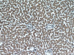 Transgelin-2 Rabbit anti-Human, Mouse, Rat, Polyclonal, Proteintech 150
