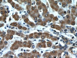 Transgelin-2 Rabbit anti-Human, Mouse, Rat, Polyclonal, Proteintech 150