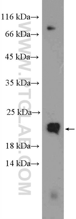Transgelin-2 Rabbit anti-Human, Mouse, Rat, Polyclonal, Proteintech 150