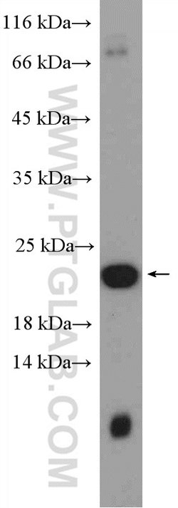 Transgelin-2 Rabbit anti-Human, Mouse, Rat, Polyclonal, Proteintech 150