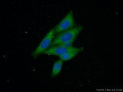 Beta galactosidase Rabbit anti-Human, Mouse, Polyclonal, Proteintech 150