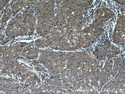 Beta galactosidase Rabbit anti-Human, Mouse, Polyclonal, Proteintech 150