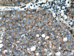 Beta galactosidase Rabbit anti-Human, Mouse, Polyclonal, Proteintech 150
