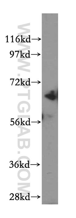 Beta galactosidase Rabbit anti-Human, Mouse, Polyclonal, Proteintech 150