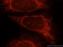 Beta galactosidase Rabbit anti-Human, Mouse, Polyclonal, Proteintech 150