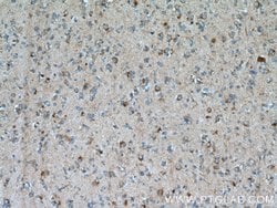 Beta galactosidase Rabbit anti-Human, Mouse, Polyclonal, Proteintech 150