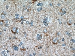 Beta galactosidase Rabbit anti-Human, Mouse, Polyclonal, Proteintech 150