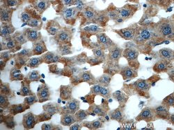 HACL1 Rabbit anti-Human, Mouse, Rat, Polyclonal, Proteintech:Antibodies:Primary