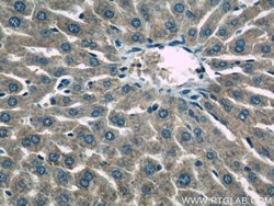 HACL1 Rabbit anti-Human, Mouse, Rat, Polyclonal, Proteintech:Antibodies:Primary